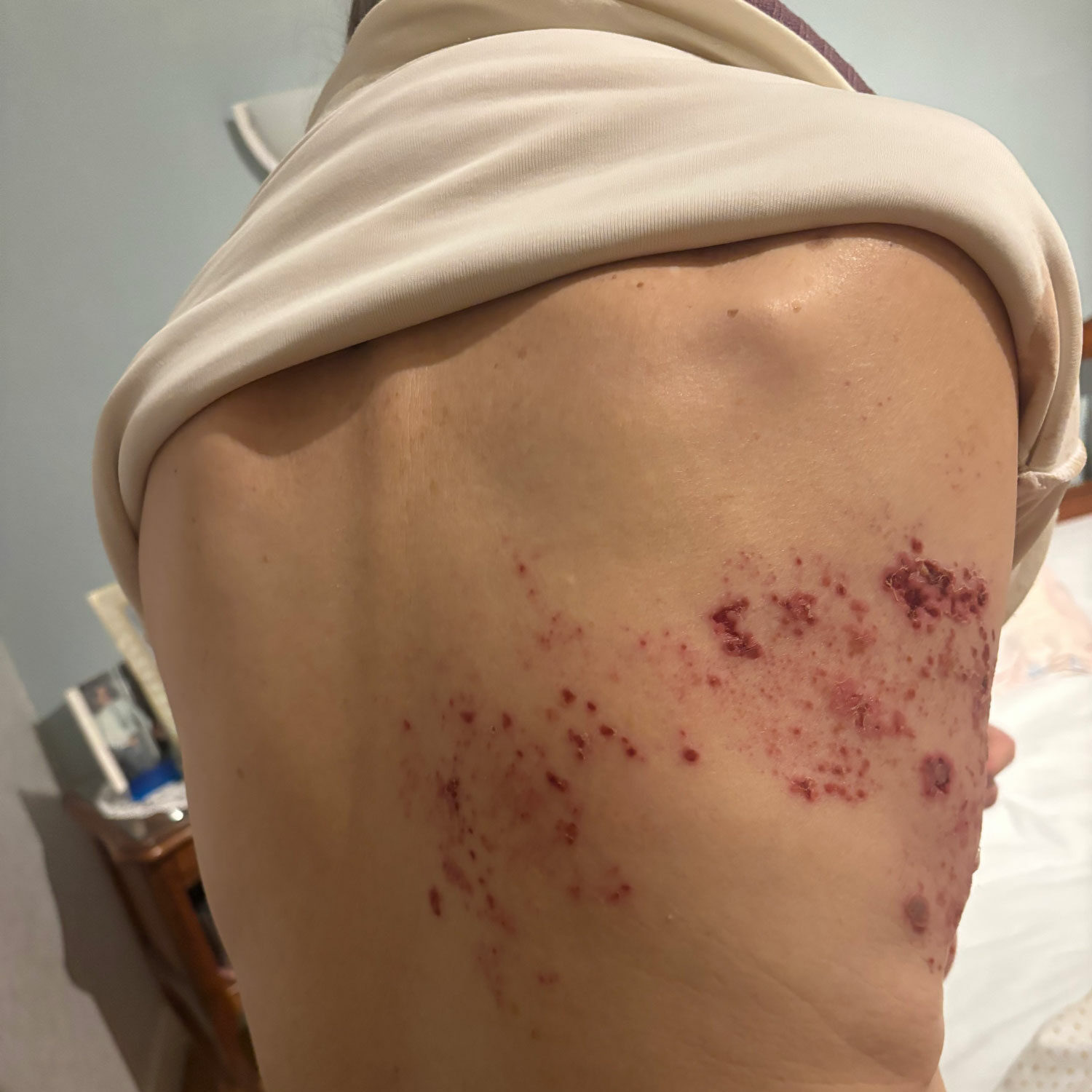 Guérison maladie de peau Le Mans